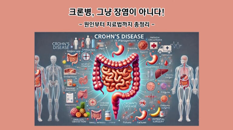 크론병, 그냥 장염이 아니다! 원인부터 치료법까지 총정리