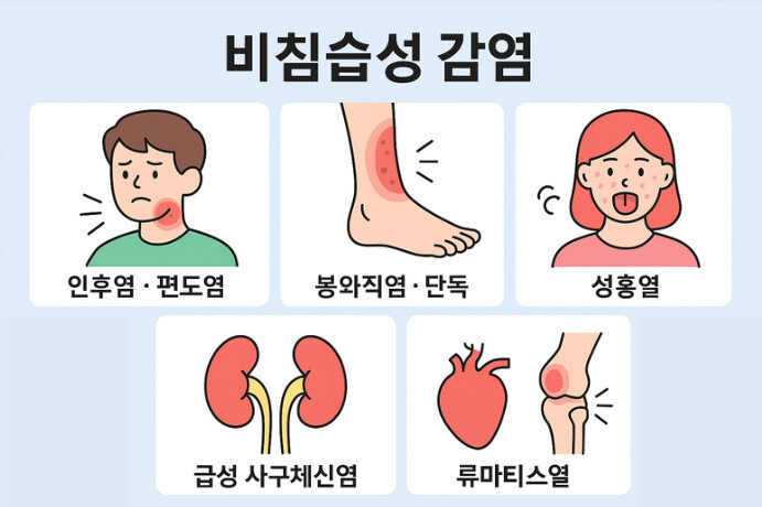 A군 연쇄상구균 감염: 비침습성 감염